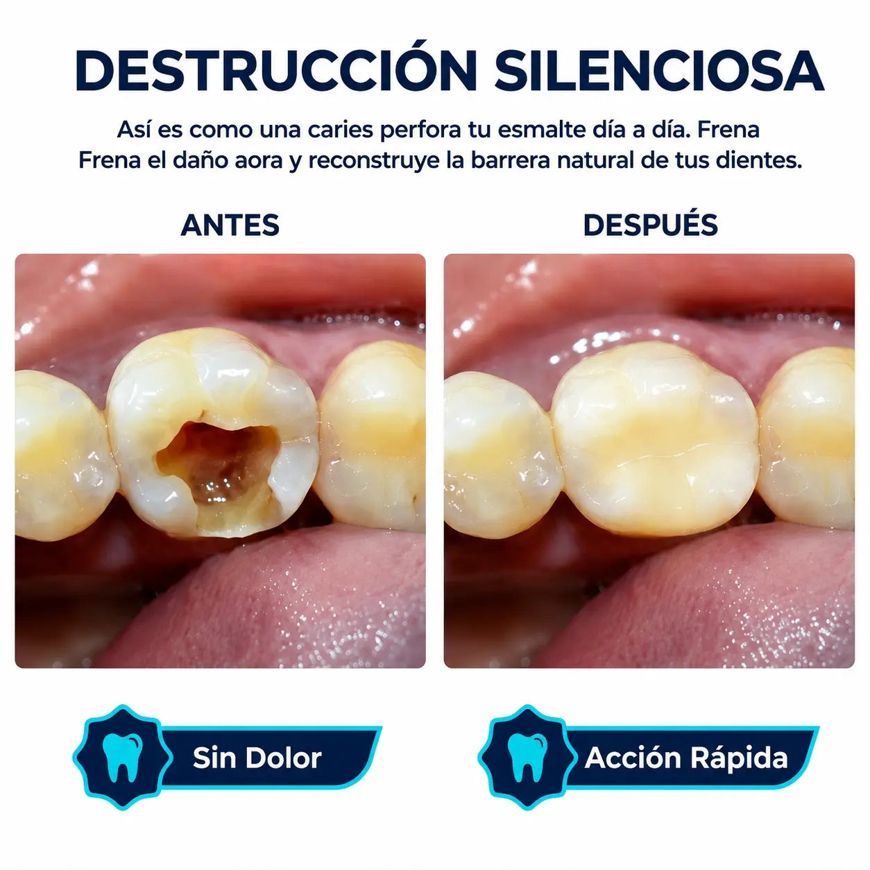 Dental Cavity Healing