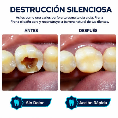 Dental Cavity Healing